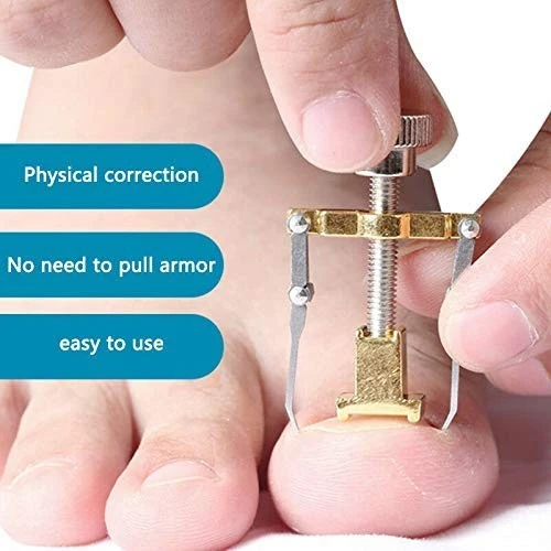 Ingrown Toenail Toe Fixer Recover Correction Device product thumbnail 9