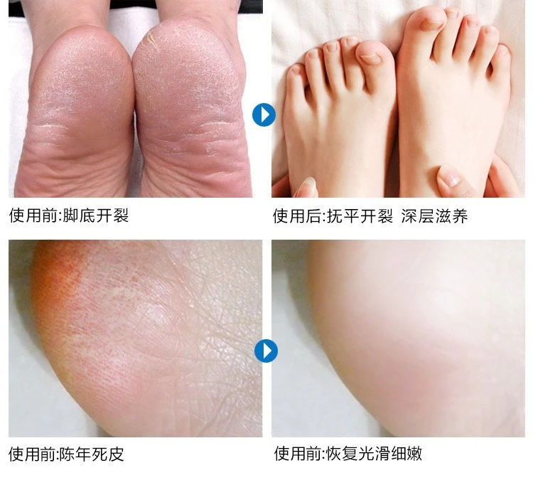 Feet Ointment For Massage Energy Cream Massage Scraper Balm 500 ml product thumbnail 15