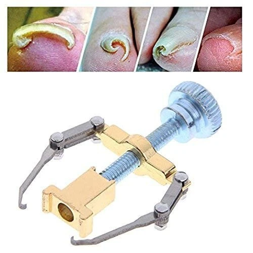 Ingrown Toenail Toe Fixer Recover Correction Device product thumbnail 11