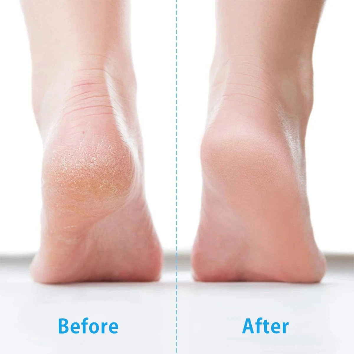 Large Rough Heel Foot Rasp File Pedicure Callus Remover Scrubber Tool Skin product thumbnail 10