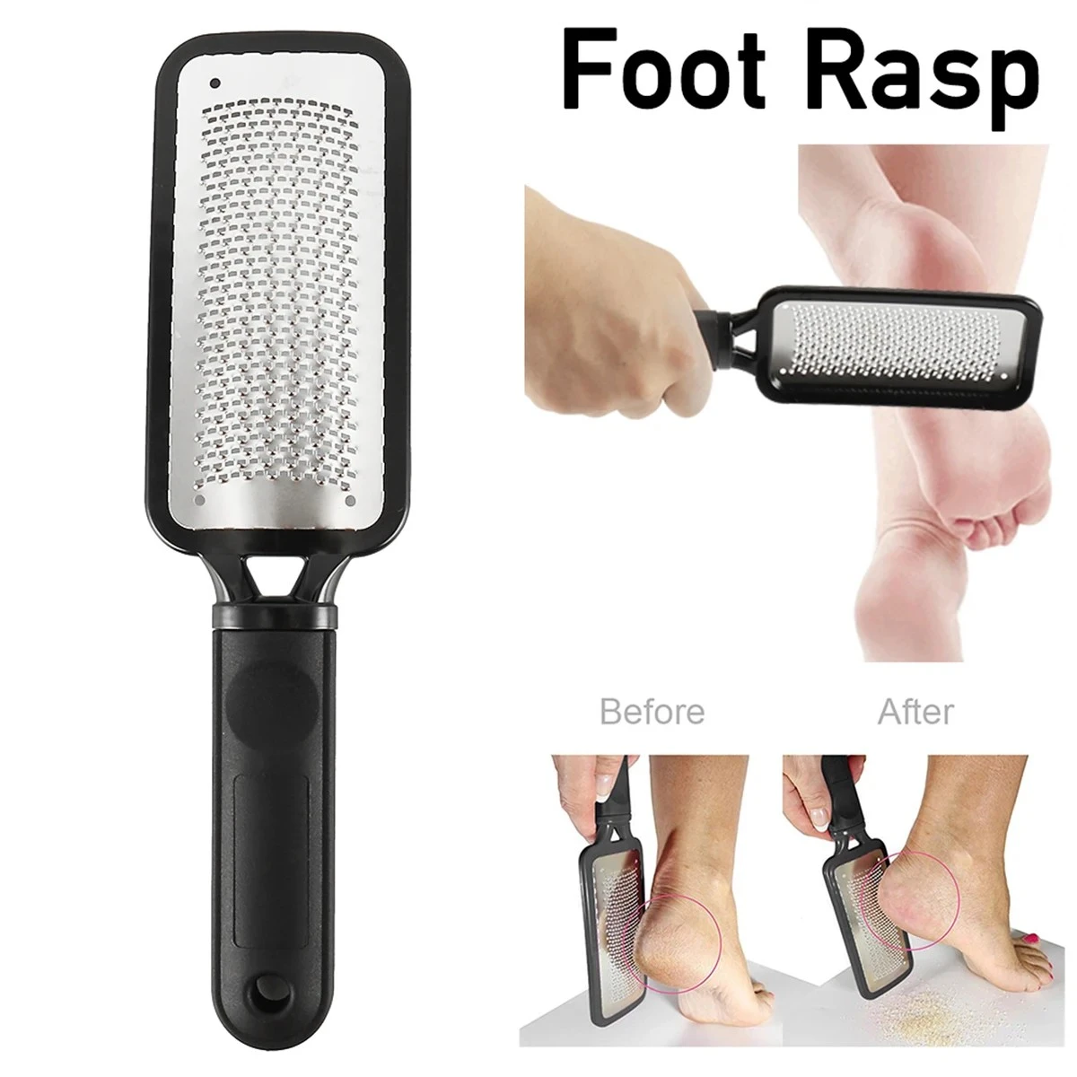 Large Rough Heel Foot Rasp File Pedicure Callus Remover Scrubber Tool Skin product thumbnail 11