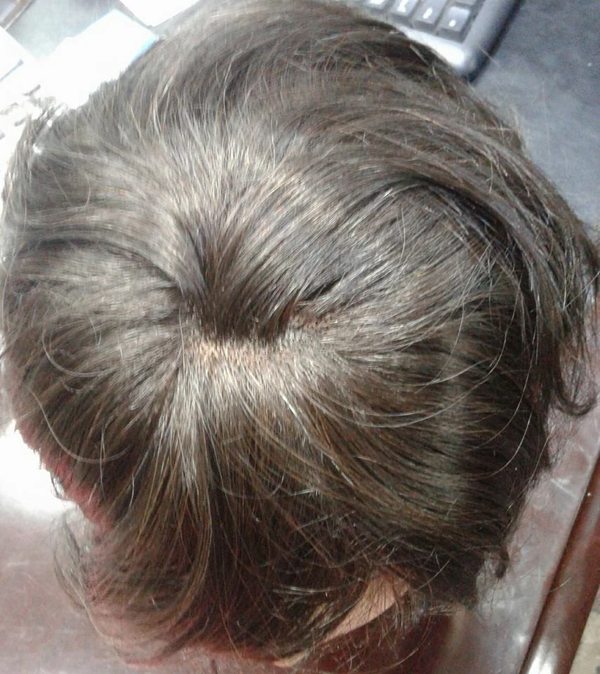 100 % Human Hair Toupee product thumbnail 7