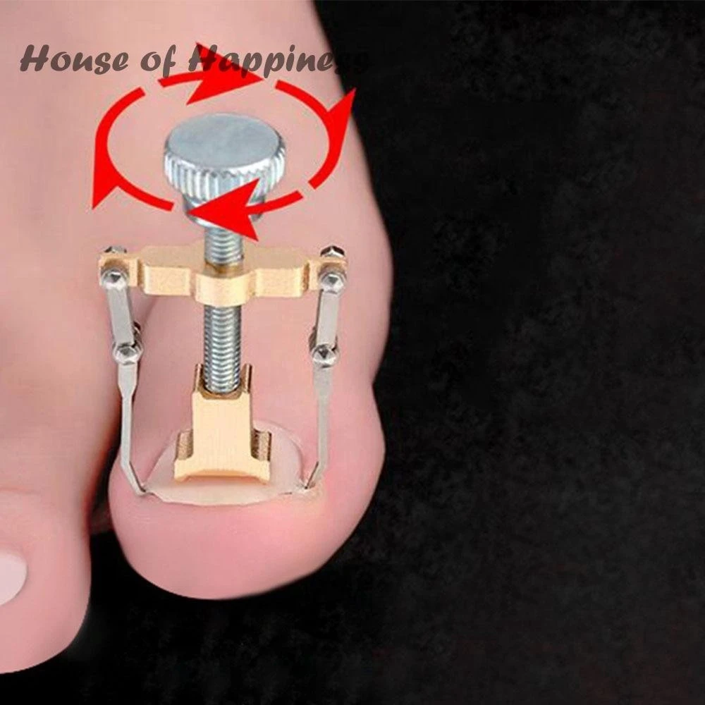 Ingrown Toenail Toe Fixer Recover Correction Device product thumbnail 14