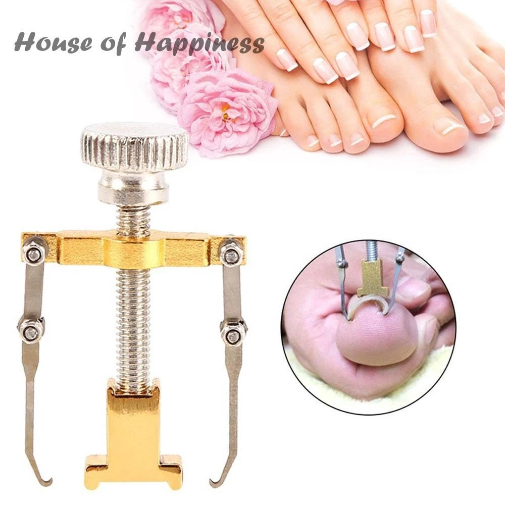Ingrown Toenail Toe Fixer Recover Correction Device product thumbnail 10