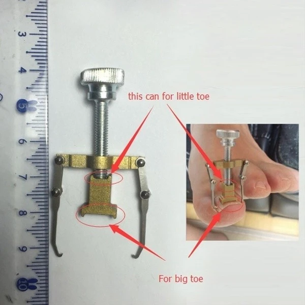 Ingrown Toenail Toe Fixer Recover Correction Device product thumbnail 8