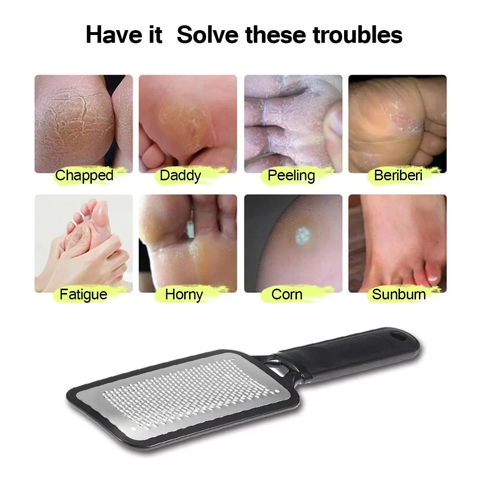 Large Rough Heel Foot Rasp File Pedicure Callus Remover Scrubber Tool Skin product thumbnail 13